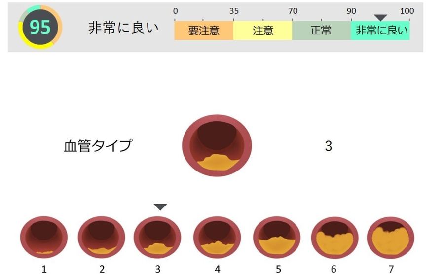 心血管の画面。7段階の血管タイプの図