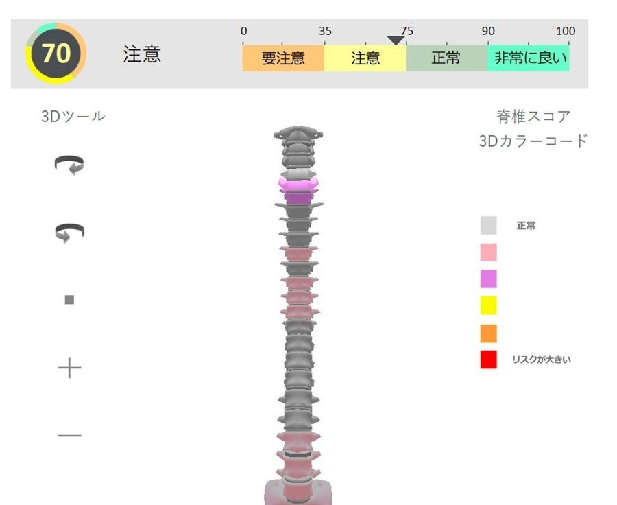 脊椎の3Dモデル。部位ごとに色で表示