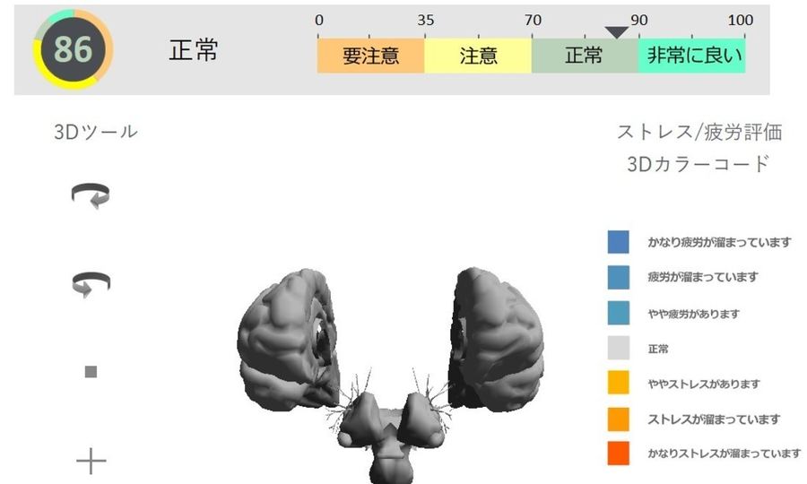 ストレスの画面。脳の3Dモデルを色で表示